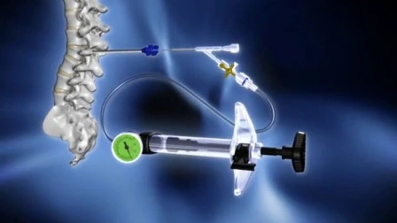 Instrumentos cirúrgicos minimamente invasivos para coluna ortopédica médica Dragon Crown